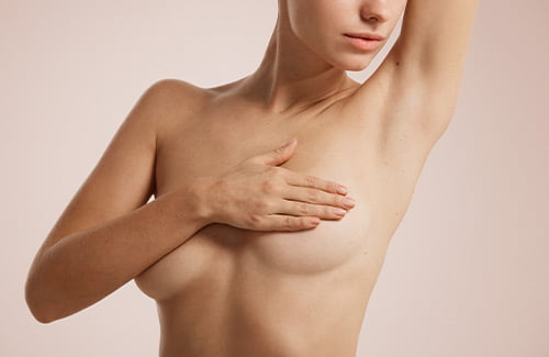 Mastopexy