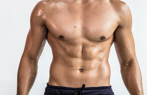 Gynecomastia