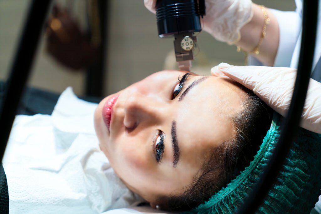 Woman getting a microneedling with radiofrequency skin treatment at a San Diego med spa
