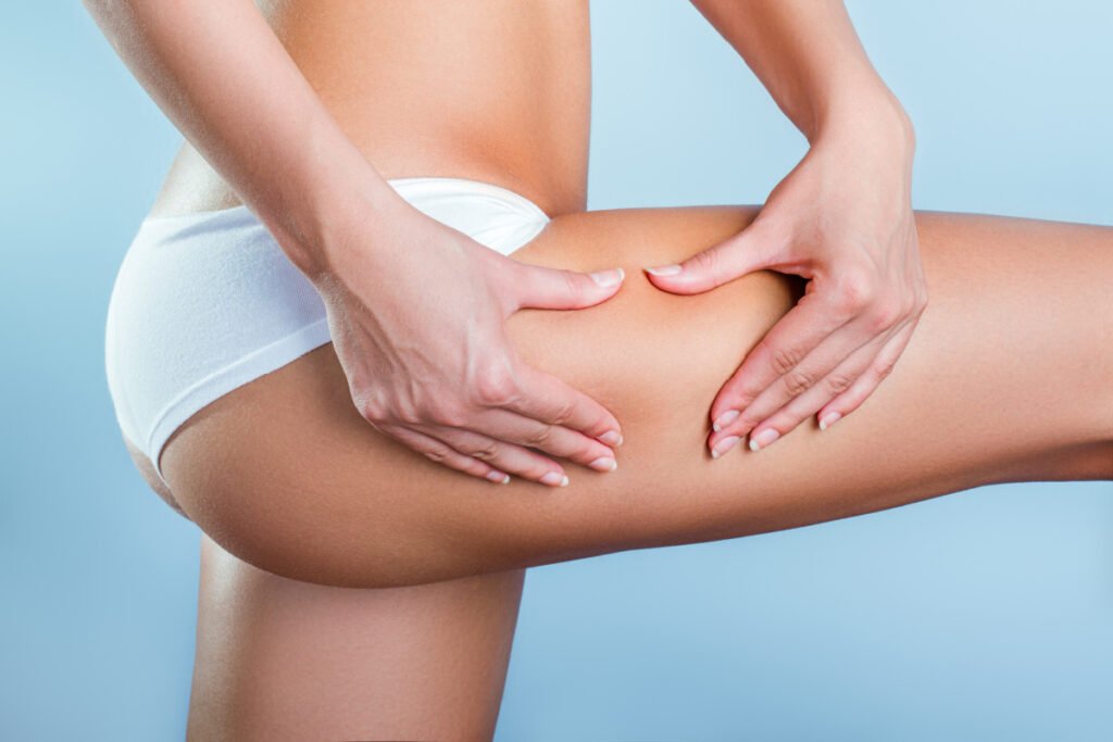 Cellulite treatments for legs, buttocks, and abdomen