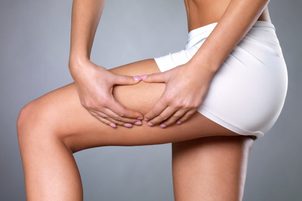 How to Reduce Cellulite in Just 30 Days