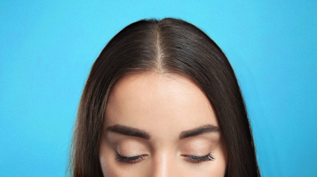 Close up of woman's forehead and high hairline against blue background