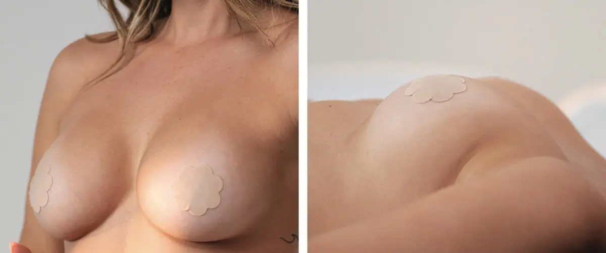 Motiva Preservé Breast Augmentation Patient Results